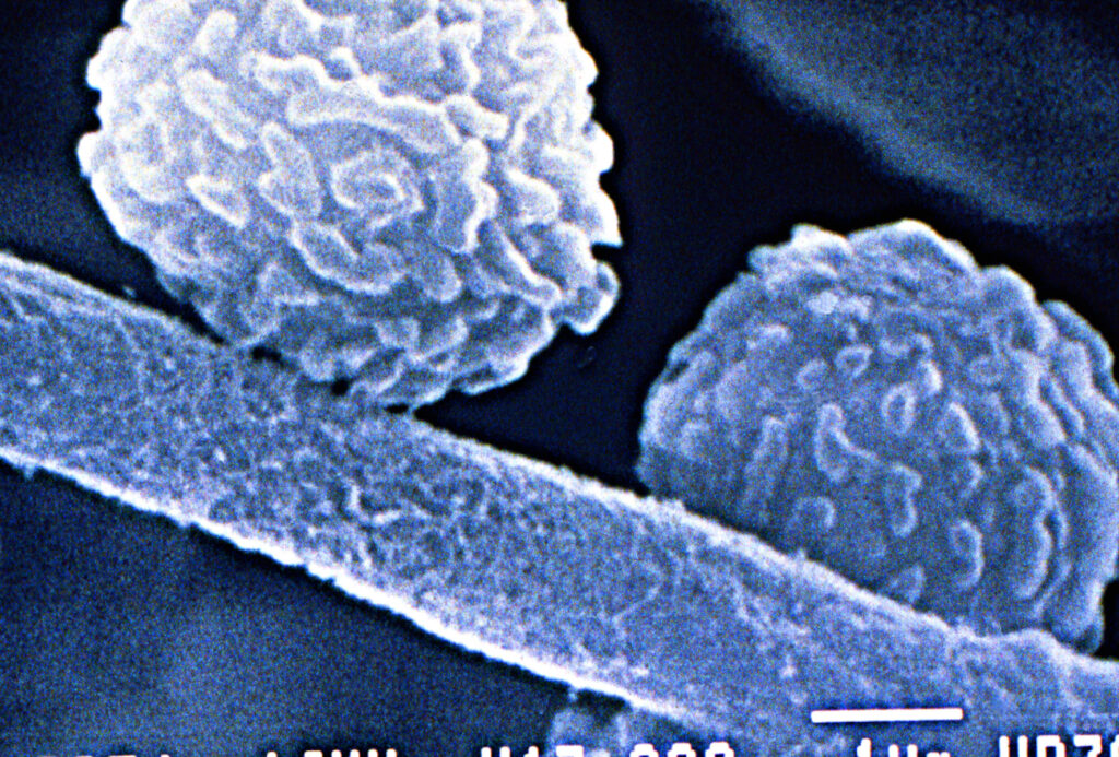 Swan electron microscope image of microbe